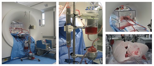 Ex Vivo Lung